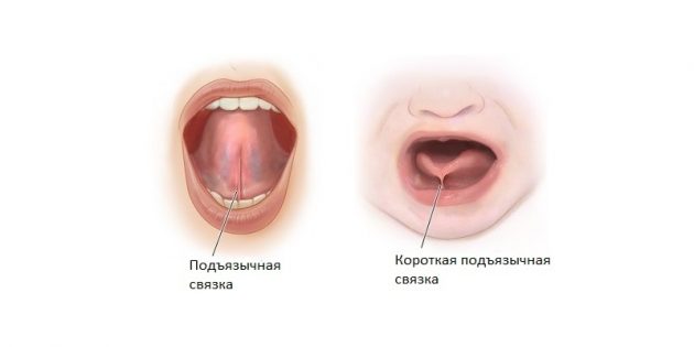 Как быстро научить ребенка говорить букву «р» самостоятельно в домашних условиях?